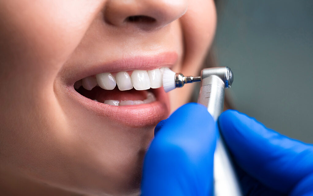 Los beneficios de las limpiezas dentales profesionales periódicas