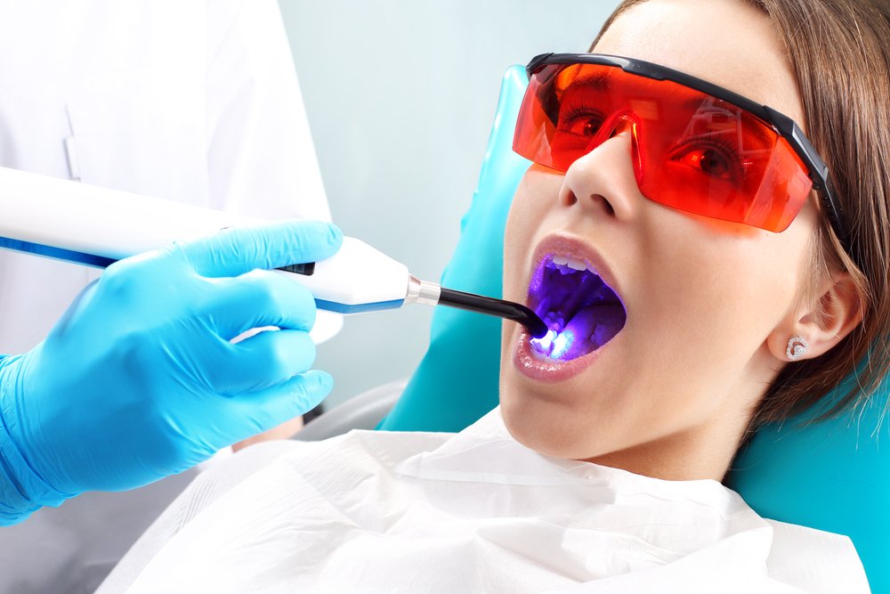Datos sobre la odontología láser: un enfoque moderno del cuidado dental