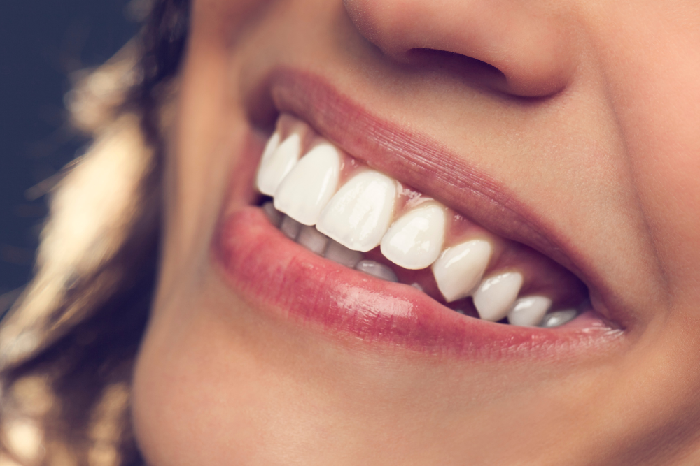 El Proceso de Diseño de la Sonrisa de Hollywood