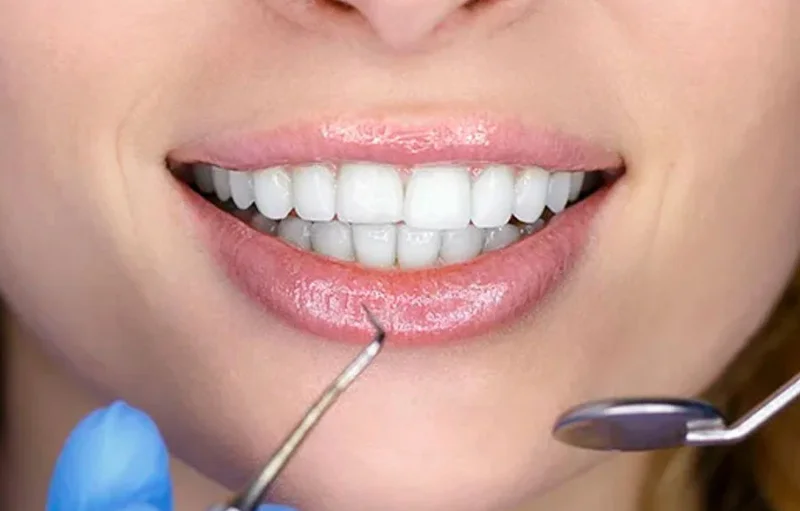 Aprenda los conceptos básicos del diseño de sonrisa