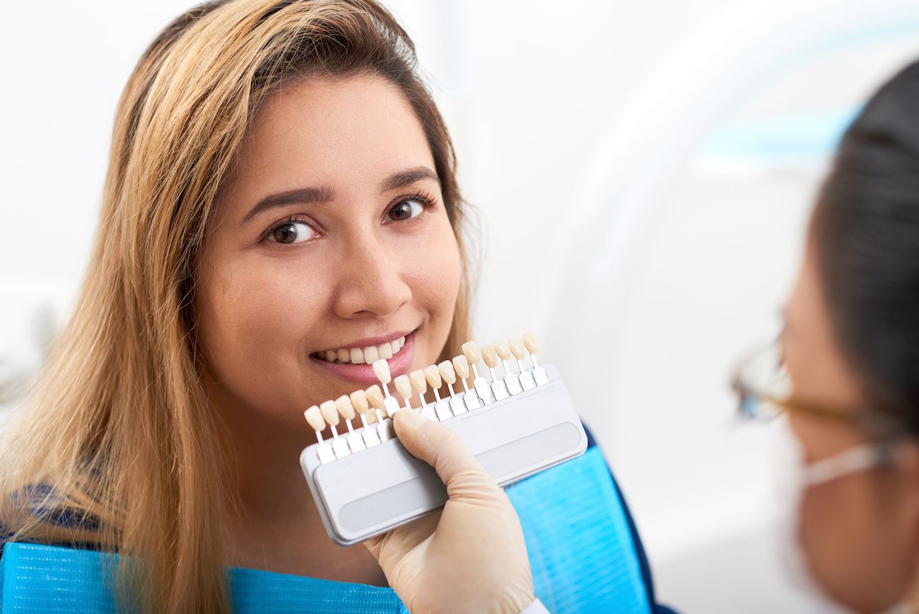 Transforme su sonrisa con carillas: la solución dental estética definitiva