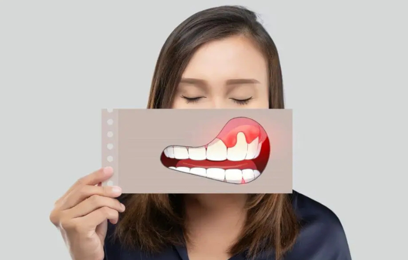 Comprender la enfermedad periodontal
