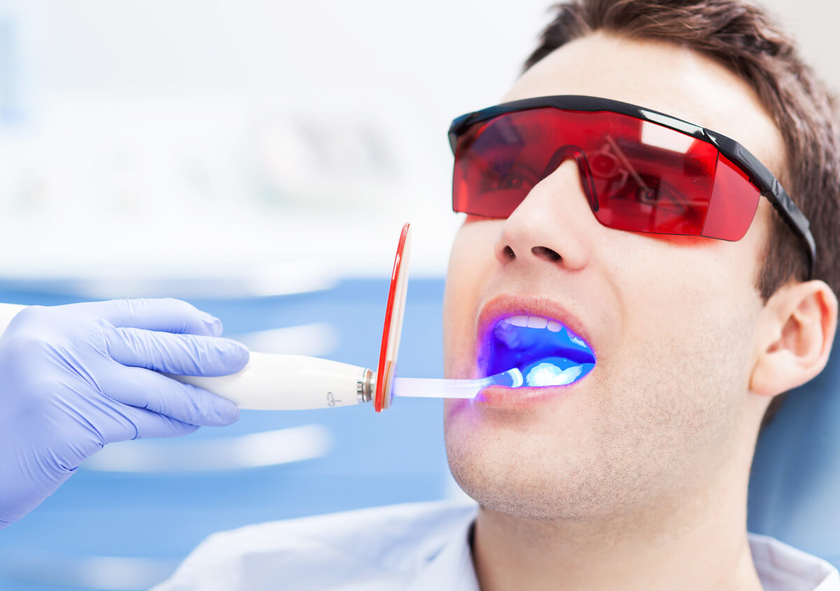Experimente el futuro de la atención dental con la odontología láser