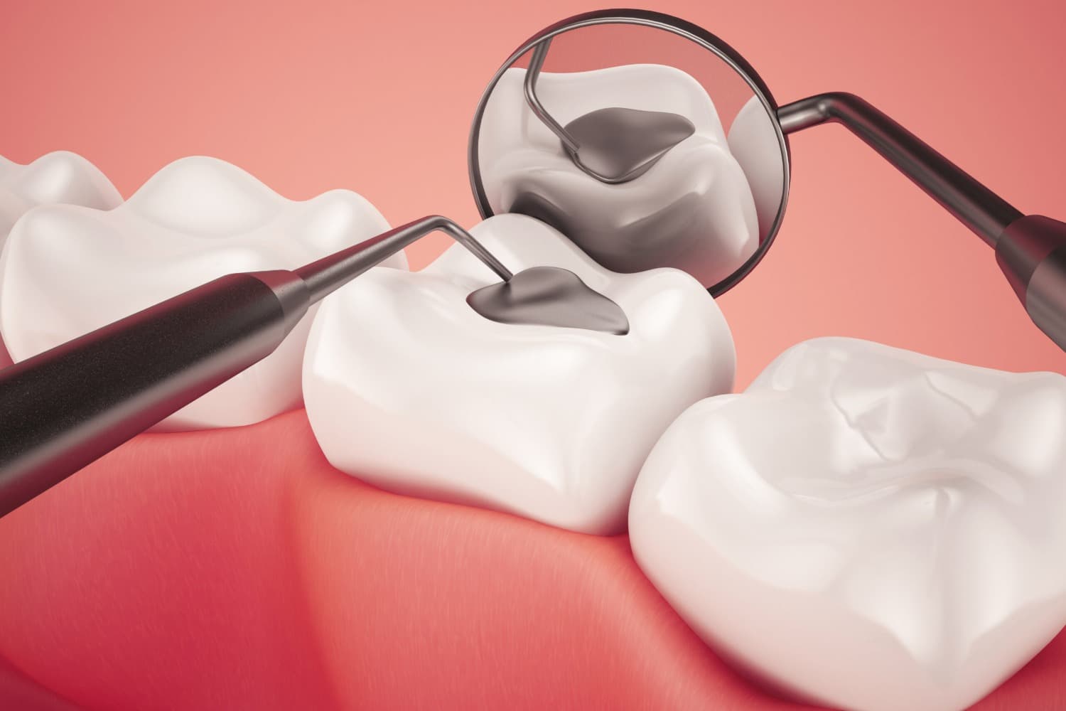 Empastes dentales: protegiendo su sonrisa